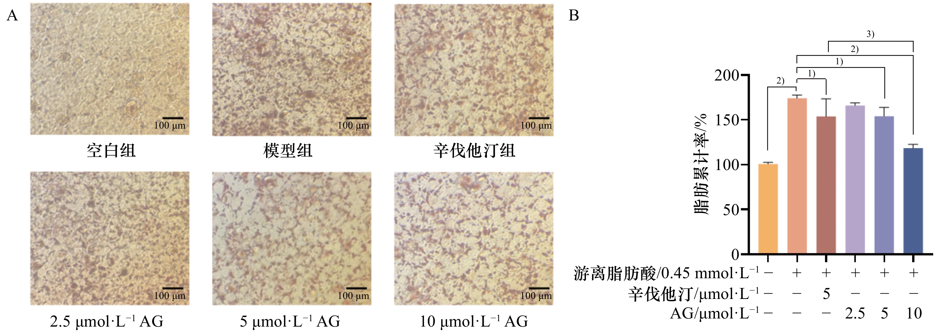 基于质谱的脂质组学研究泽泻醇G对HepG2细胞脂肪累积模型中的脂质代谢的影响
